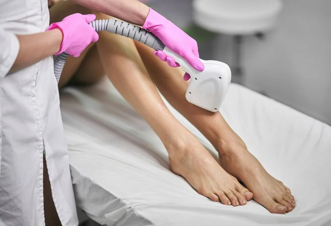 Laser hair removal on a client's lower legs